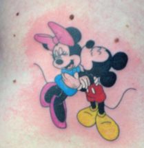 Mickey en Minnie Mouse op bovenarm